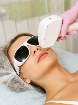 Laser Treatments