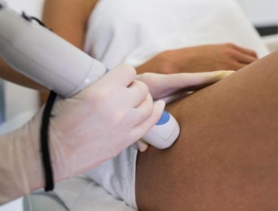 Smooth, Hair-Free Skin with Laser Removal